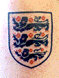 [The England badge]
